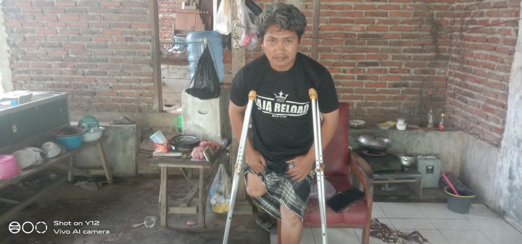 AAN ANSORI BERHARAP” PEMERINTAH ATAU INTANSI TERKAIT SERTA PARA DERMAWAN” MAU BANTU KAKI PALSU.