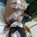 Diduga Sakit Hati Kerena Tak Dihargai,Bacok Korban Berkali-kali Hingga Korban Tak Berdaya Bukan Isap Jempol Belaka.