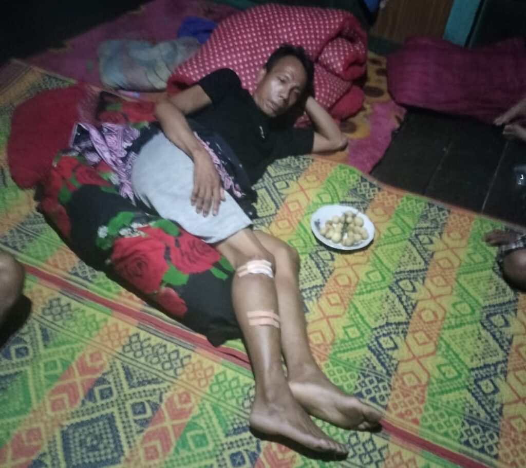 Warga Di Serang Binatang Buas Luka Robek Pada Kaki