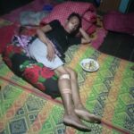 Warga Di Serang Binatang Buas Luka Robek Pada Kaki