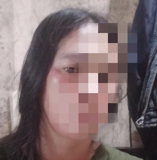 Inaya Seorang Perempuan Jadi Korban Penganiayaan Di Kabupaten Gowa