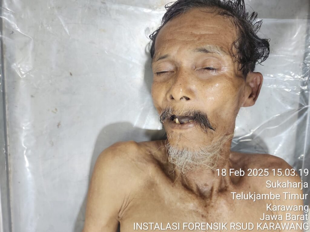 Kakek Tanpa Identitas Ditemukan Meninggal di Angkot, Polisi Lakukan Identifikasi