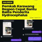 Pemkab Karawang Bergerak Cepat Bantu Balita Penderita Hydrocephalus