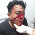 Jalan Toang Jalur Ciasem – Blanakan Rawan Begal, Dua Orang Korban Pembegalan Bersimbah Darah.