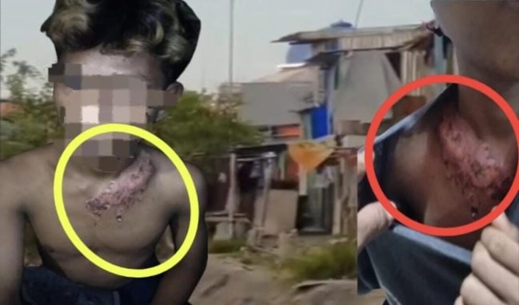 Miris!! Remaja Makassar Diduga Disiram Kopi Panas Saat Diamankan Oknum Brimob