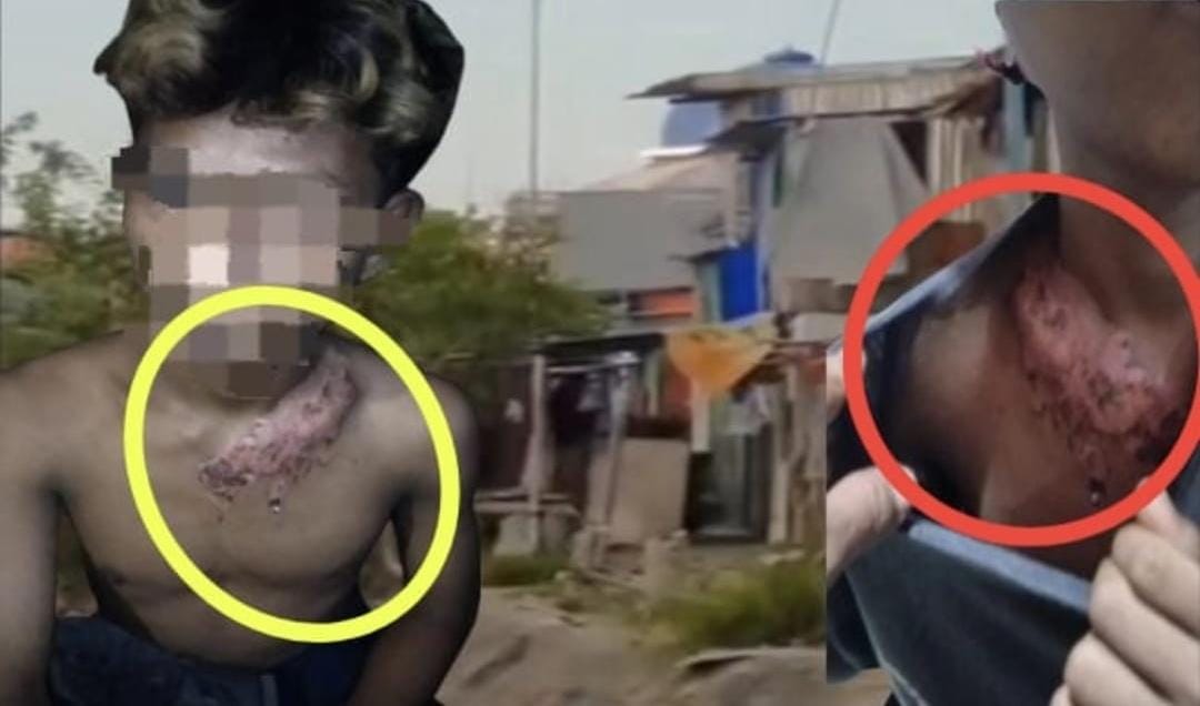 Miris!! Remaja Makassar Diduga Disiram Kopi Panas Saat Diamankan Oknum Brimob