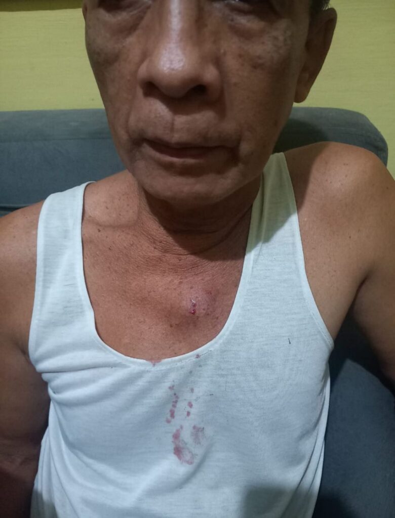 Korban Pengeroyokan Jadi Tersangka, Syahruddin Sudah 24 Hari Ditahan di Polsek Tamalate