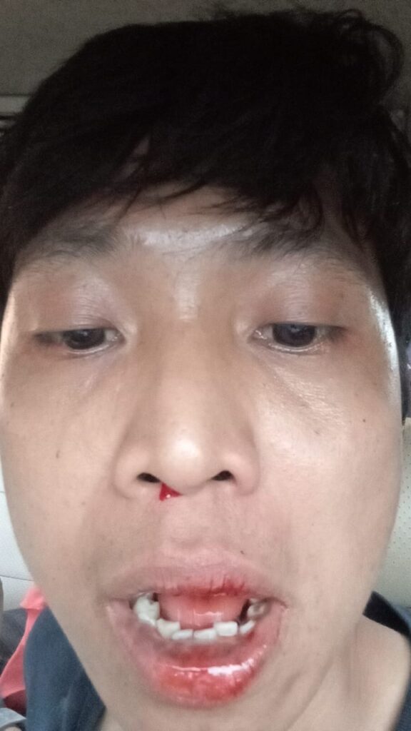 Tipikornews.com Menentang Keras Pengeroyokan Wartawan di Batanghari , Polisi Harus Berani Usut Sampai Akhir!