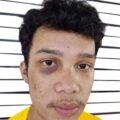 Tiga Tersangka Masih Bebas Berkeliaran, Pelapor Penganiayaan Berat Minta Polrestabes medan Tangkap 3 Pelaku Lainnya