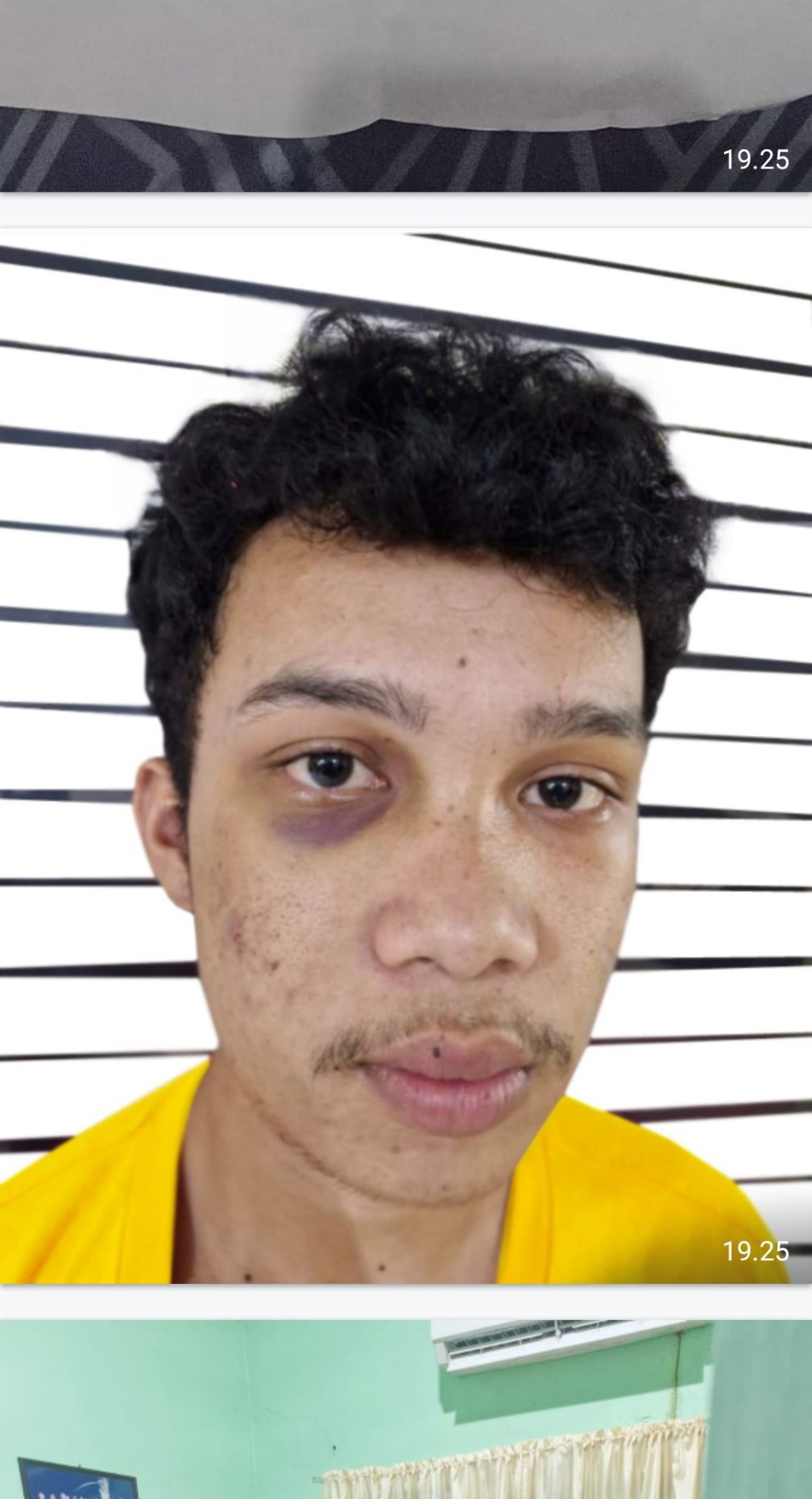 Tiga Tersangka Masih Bebas Berkeliaran, Pelapor Penganiayaan Berat Minta Polrestabes medan Tangkap 3 Pelaku Lainnya