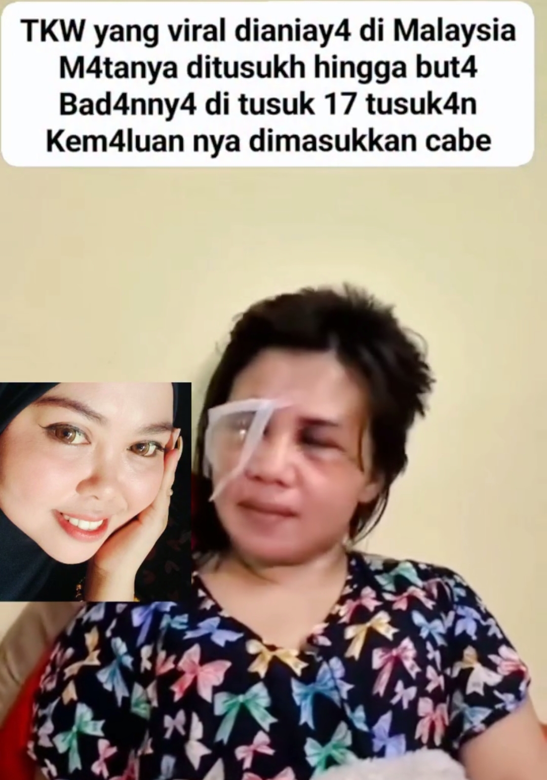 DEWAN PAKAR DPP LSM ELANG MAS PROF DR SUTAN NASOMAL MENYESALKAN TENAGA KERJA ART DI ANIAYA DI MALAYSIA SANGAT KEJI DI LUAR BATAS PRIKEMANUSIAAN.