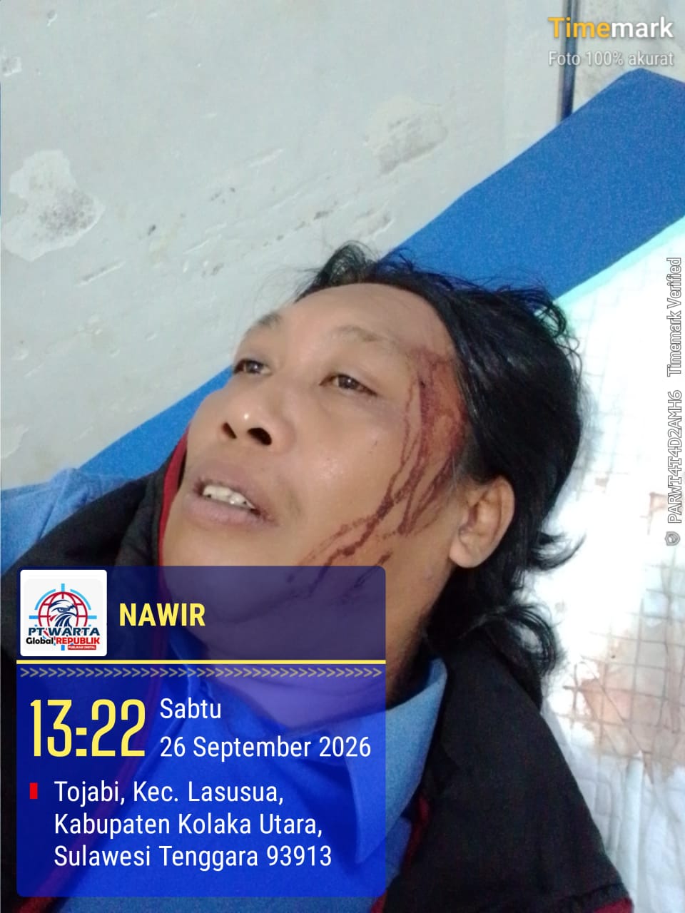 DEWAN PAKAR DPP LSM ELANG MAS Prof. Dr. Sutan Nasomal: Minta Dewan Pers Mengawal Pemukulan Wartawan di Kolut – Tak Boleh Didiamkan! KAPOLRI & KAPOLDA SULTRA DIMINTA TURUN TANGAN!